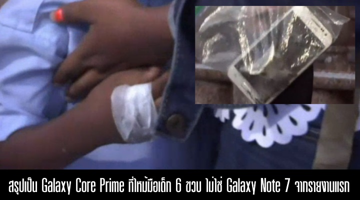 สรุปเป็น Galaxy Core Prime ที่ไหม้มือเด็ก 6 ขวบ ไม่ใช่ Note 7 อย่างที่เป็นข่าวในตอนแรก