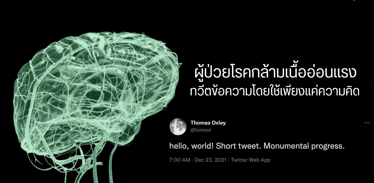 ผู้ป่วยโรคกล้ามเนื้ออ่อนแรง (ALS) สามารถทวีตข้อความลง Twitter โดยใช้เพียงแค่ความคิดเท่านั้น