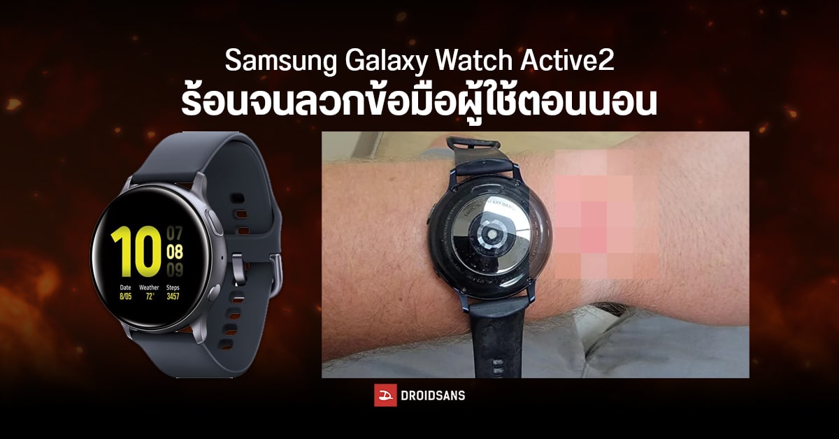 Samsung Galaxy Watch Active2 เกิดความร้อนจัดจนลวกข้อมือผู้ใช้ระหว่างนอน คาดสาเหตุจากแบตเสื่อม